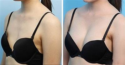 Cách chọn bikini chuẩn, vòng 1 tăng ít nhất 2 size