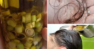 Chữa rụng tóc kinh niên hiệu quả sau 1 lần sử dụng 
