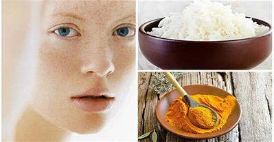 Đánh bay nám, tàn nhang trên da chỉ với hỗn hợp từ cơm