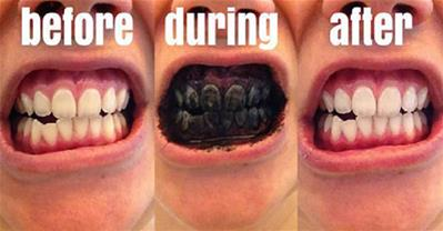 Đánh răng bằng than để có hàm răng trắng sáng