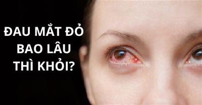 Đau mắt đỏ bao lâu thì khỏi? Mẹo chữa đau mắt đỏ nhanh nhất