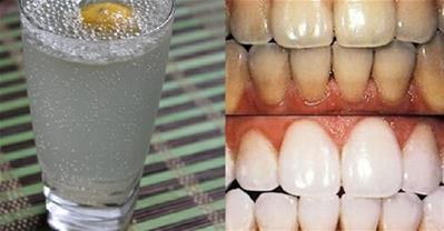 Tổng hợp các cách làm trắng răng hiệu quả và rẻ tiền