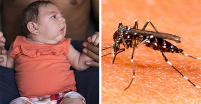 Virus Zika gây bệnh teo não, siêu quan trọng cho mẹ bầu